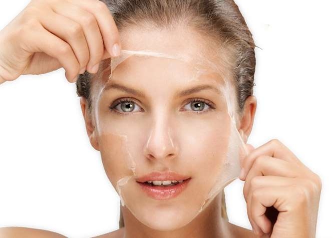 Asit İle Yüz Soyma (Peeling)