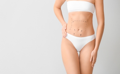 Abdominoplasty – Tummy Tuck